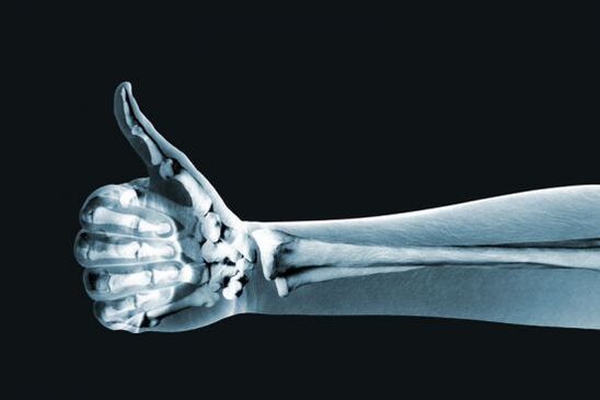 Raze X pot ajuta la diagnosticarea durerii în articulațiile degetelor