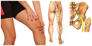 dureri de spate și de picioare de tratament